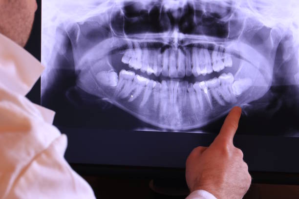 Best Emergency Broken Tooth Repair in Wyldwood, TX